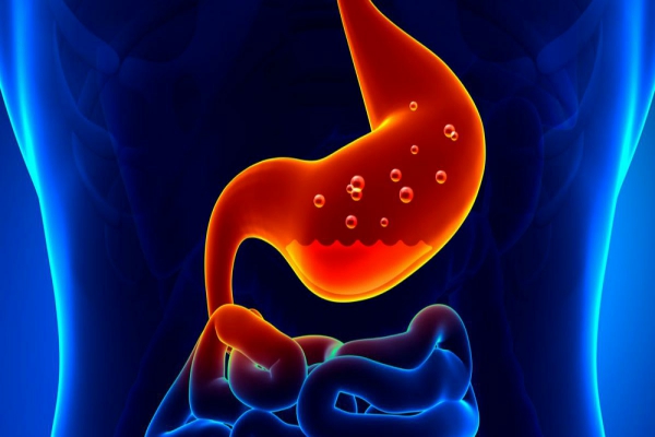 Gastritis